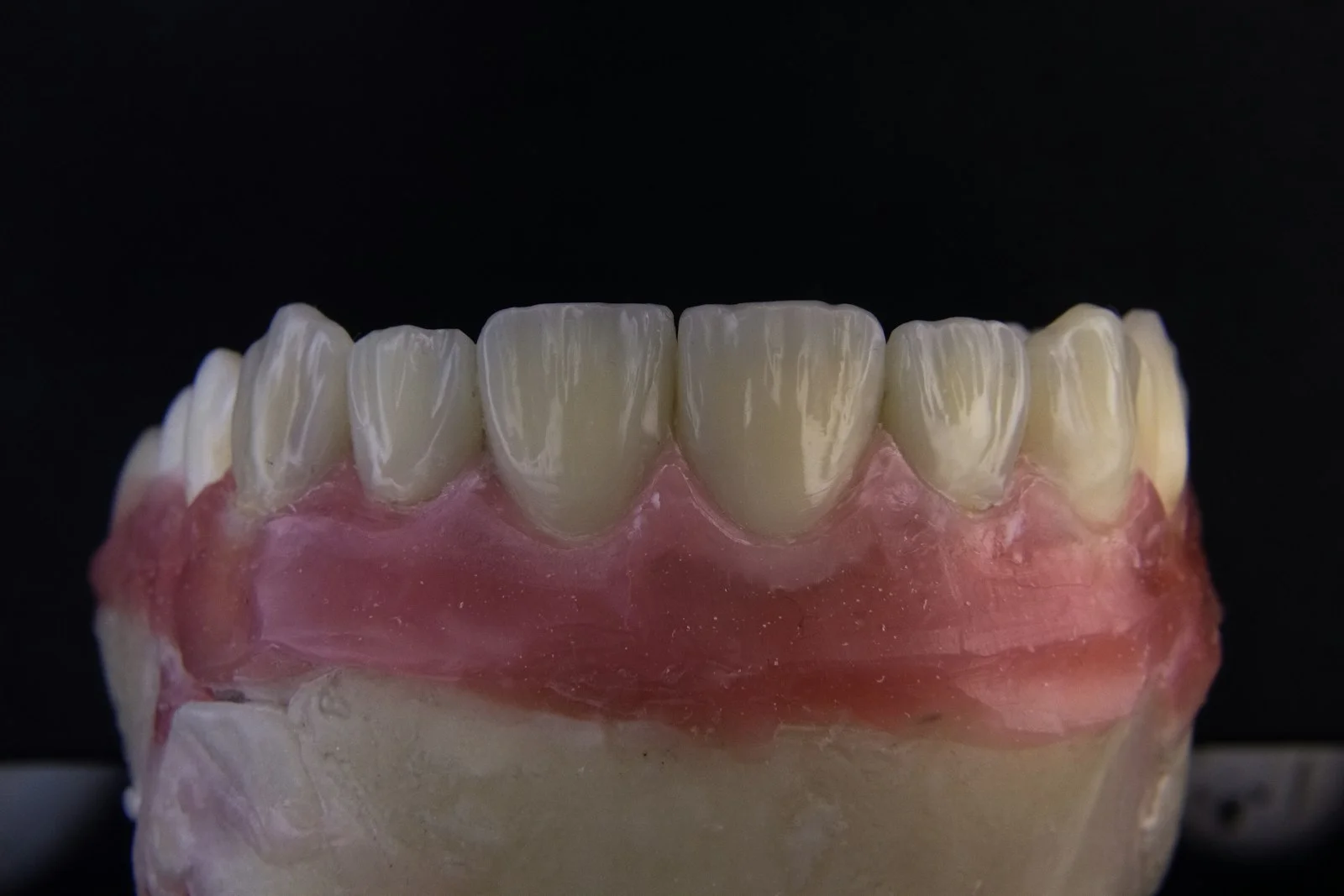a close up of a tooth with gumpaste on it a close up of a tooth with gumpaste on it